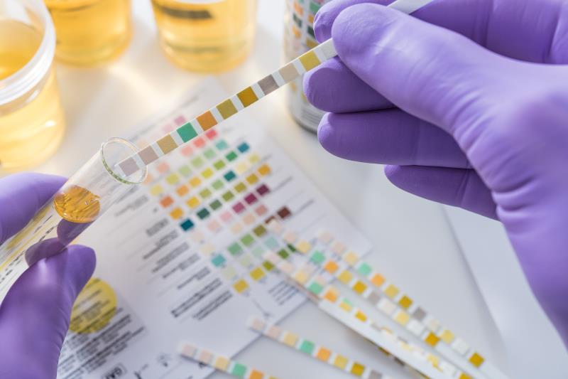 chemical strip tests ph chlorine